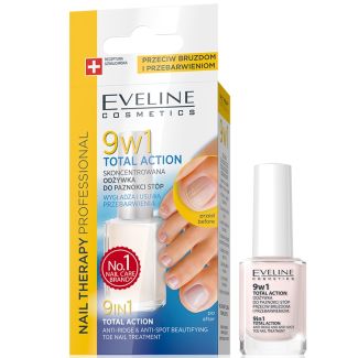 Eveline - 9 in 1 Total Action Anti-Ridge Toe Nail Treatment Wholesale